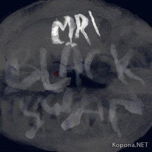 Mri  Black Swan (2011)